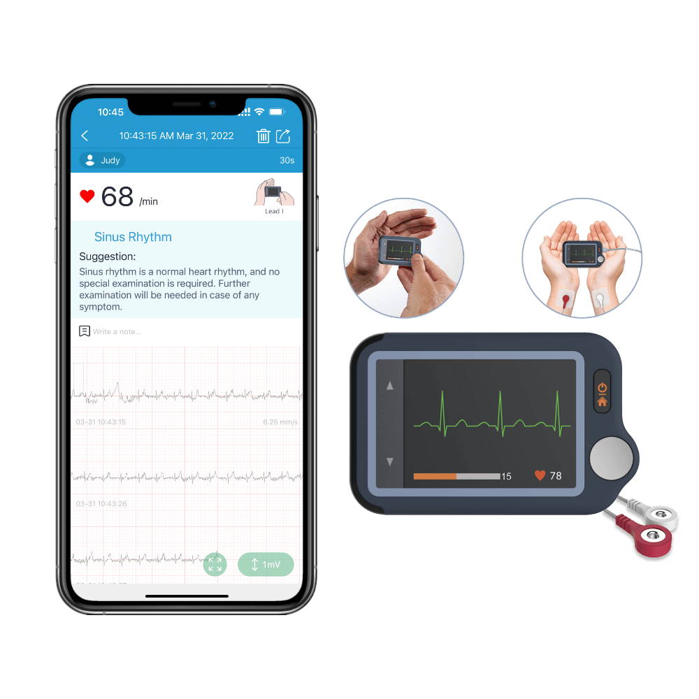 Wellue DuoEK ECG Monitor. Wearable EKG Monitor w/ Free APP PC Software